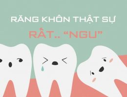 răng khôn