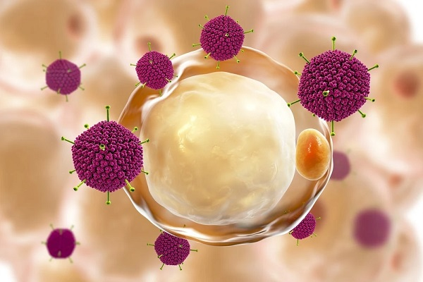 Nguyên nhân gây viêm kết mạc mãn tính chủ yếu là do vi khuẩn, virus