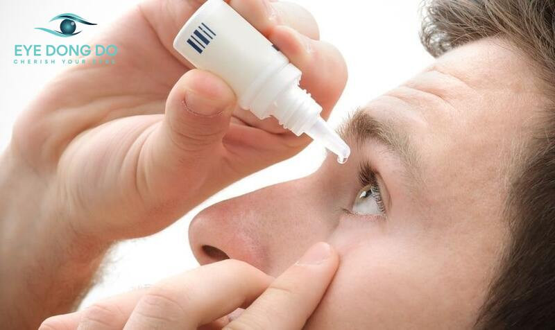 Sử dụng thuốc theo chỉ định của bác sĩ để điều trị nấm mắt