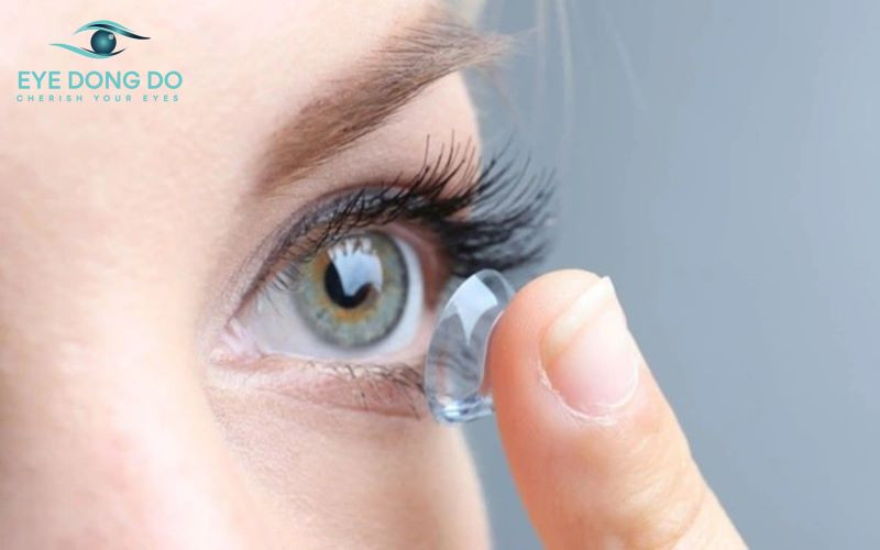 Kính áp tròng được thay thế cho kính gọng