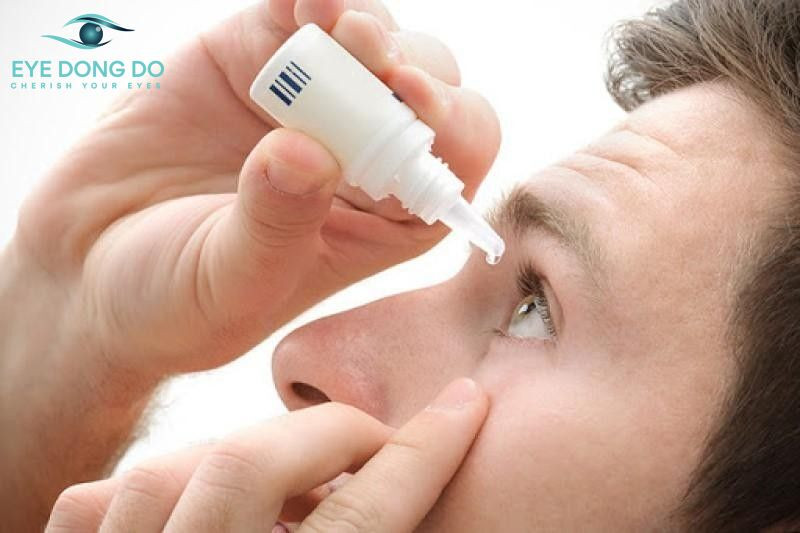 Dùng thuốc để điều trị bệnh cườm nước