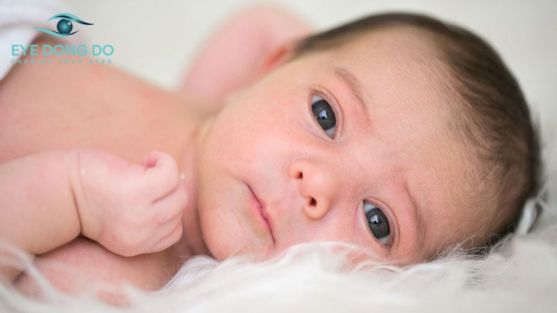 Đục thủy tinh thể bẩm sinh xảy ra ngay khi trẻ mới chào đời