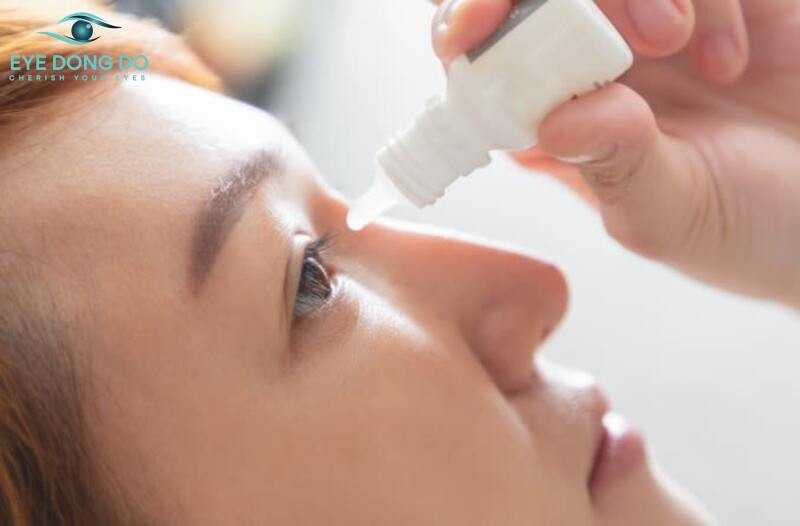 Thuốc nhỏ mắt điều trị bệnh viêm giác mạc do virus herpes