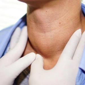 Siêu âm thấy nhân giáp: Đừng hoảng loạn, nhưng cũng đừng bỏ qua!